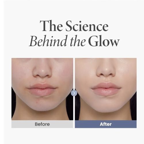 کرم ترانگزامیک اسید 2.5% اکسیس وای ضدلک و روشن کننده پوست حجم 50 میل AXIS-Y TXA 2.5% Intensive Brightening Cream