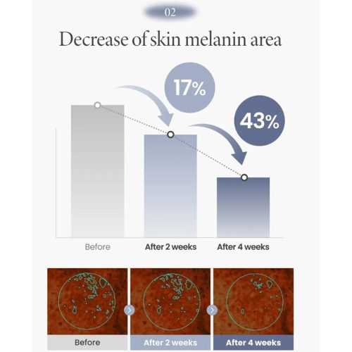 کرم ترانگزامیک اسید 2.5% اکسیس وای ضدلک و روشن کننده پوست حجم 50 میل AXIS-Y TXA 2.5% Intensive Brightening Cream